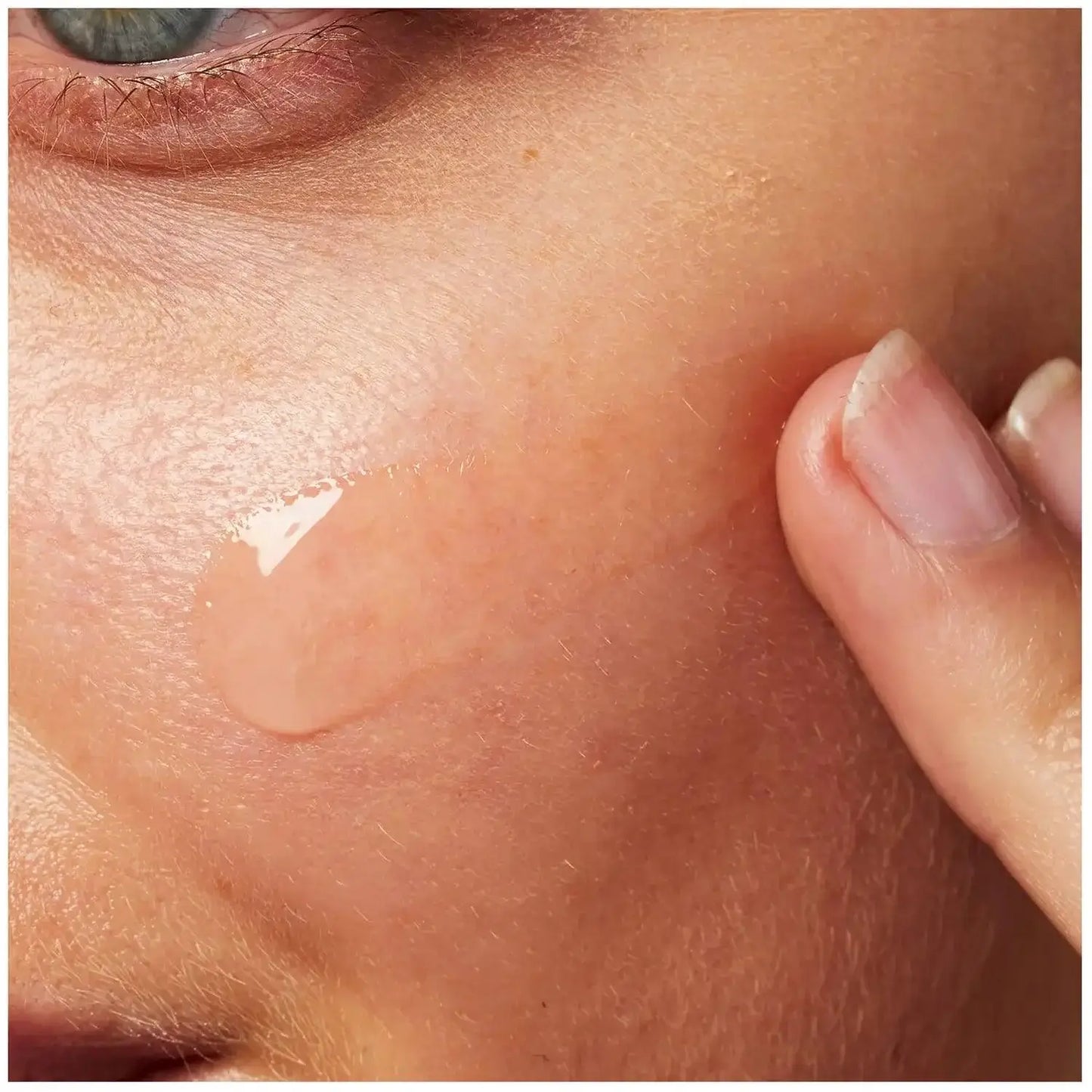 Close-up of a hand applying CeraVe Blemish Control Gel Moisturiser onto blemish-prone skin.