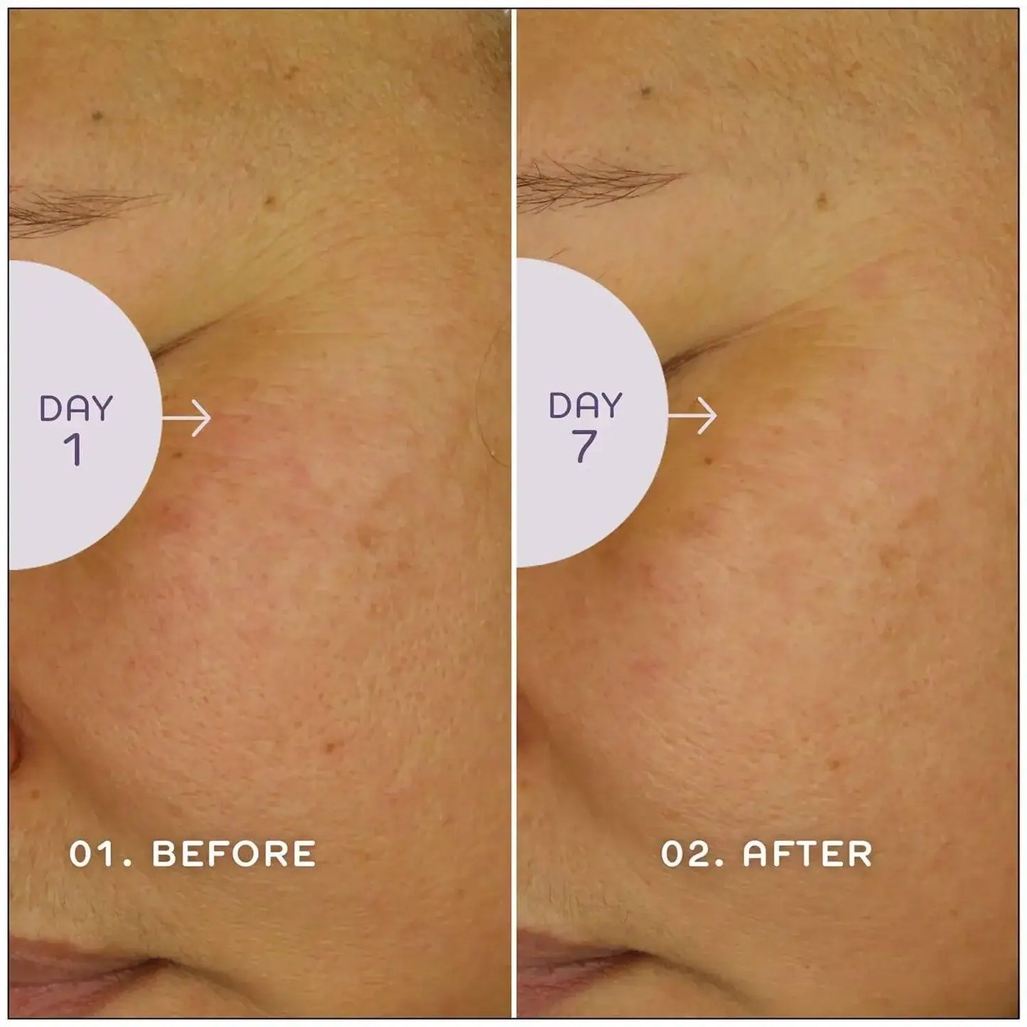 Comparison of skin improvement after using REN Bio Retinoid Youth Serum for 7 days, showing visible reduction in fine lines.