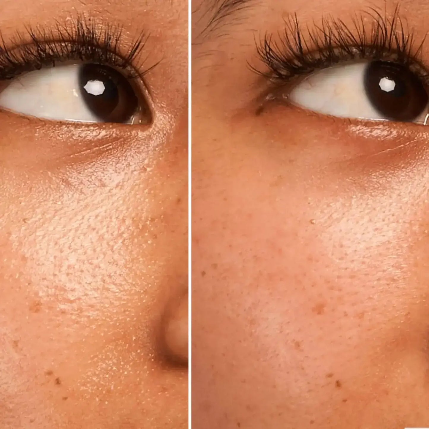 Before and after results showing improved skin texture and minimized pores using GLOW RECIPE Strawberry BHA Pore-Smooth Blur Drops.