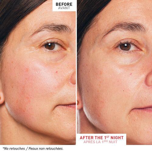 Before and after results showcasing Skin Therapy night oil serum effects on skin after one night.