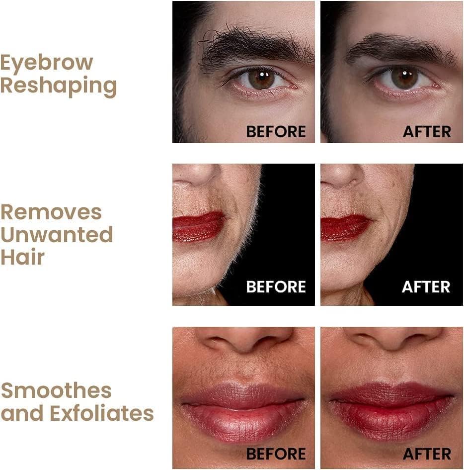 Before and after effects of a Hollywood Browzer procedure on eyebrows, lips, and face.