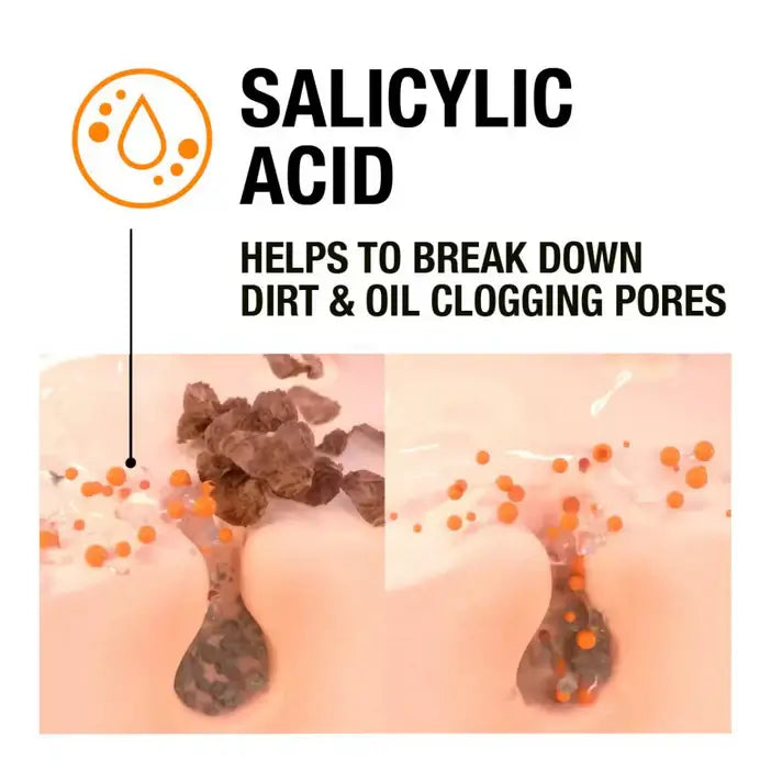Illustration of salicylic acid helping to break down dirt and oil clogging pores on skin.
