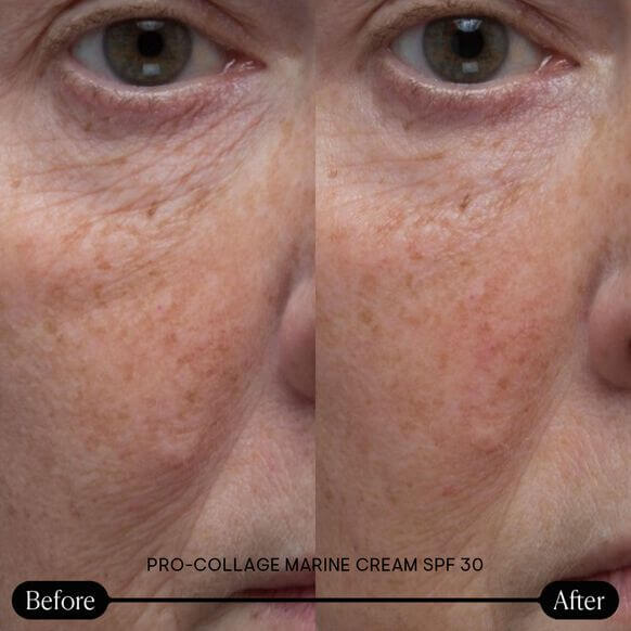 Before and after comparison of facial skin with Elemis Pro-Collage Marine Cream SPF 30 application.
