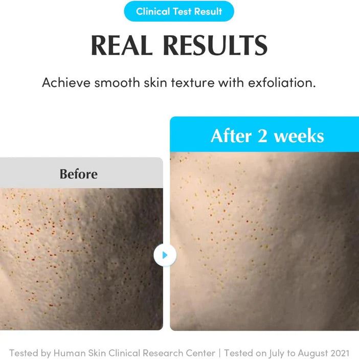 Before and after comparison of skin texture with Eqqualberry exfoliation, showing smooth skin after 2 weeks.