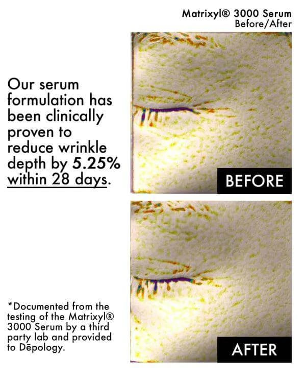 Before and after results of Matrixyl® 3000 Serum demonstrating a 5.25% reduction in wrinkle depth in 28 days.