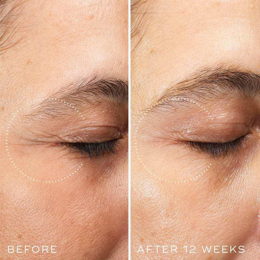 Side-by-side comparison of eye area before and after 12 weeks of using Medik8 Crystal Retinal Ceramide Eye serum.