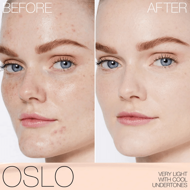 Before and after comparison of NARS Light Reflecting Foundation in Oslo, showcasing improved skin tone and coverage.