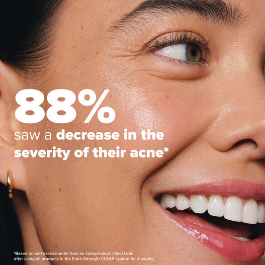 Close-up of a woman's face with text indicating a 88% decrease in acne severity. Paula's Choice