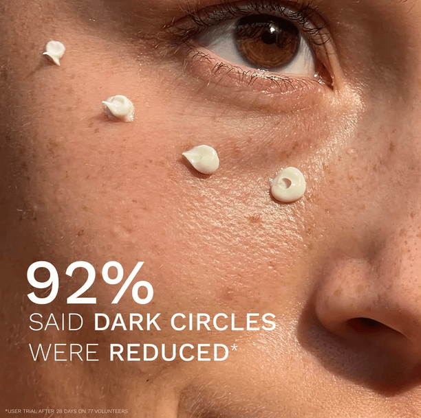 Close-up of a person's eye with Reneye cream, showcasing 92% improvement in dark circles reduction.