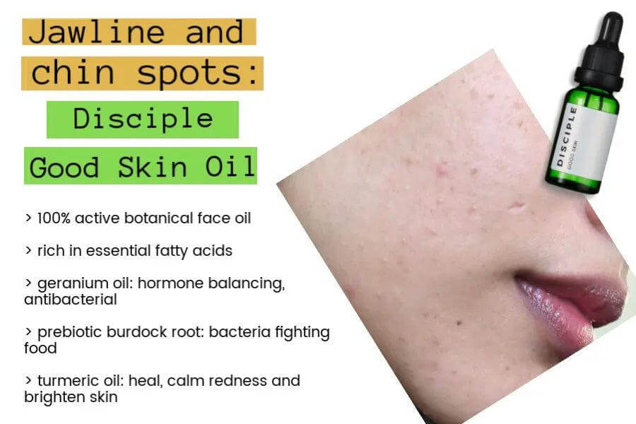 Disciple Good Skin Oil-Serum 20ml for jawline and chin spots, 100% active botanical face oil for clear, bright skin.