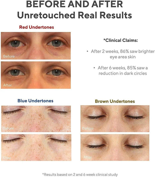 Before and after results showcasing the Murad Vita-C Eyes treatment efficacy on red, blue, and brown undertones.
