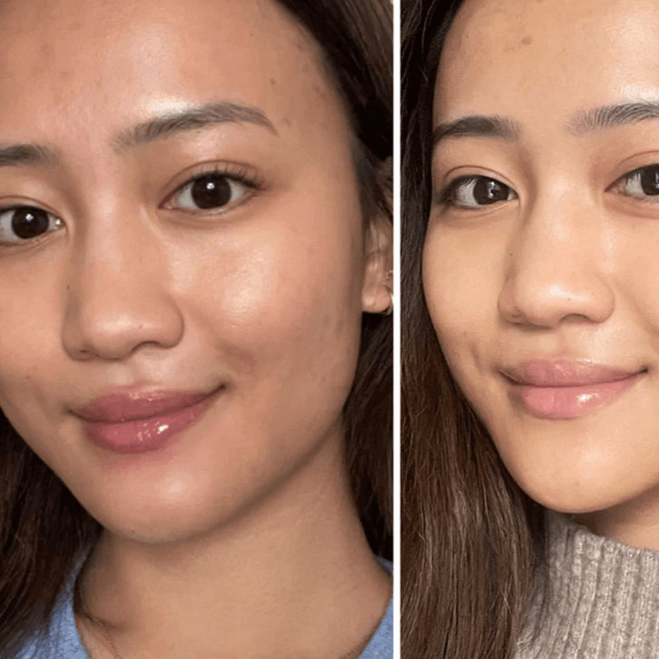 Before and after photos showcasing clear, radiant skin after using Alpha-H Liquid Gold with 5% Glycolic Acid.