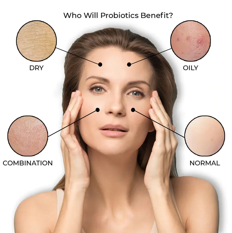 Infographic showing Doctors Formula skin types: dry, oily, combination, and normal with benefits of probiotics for each type.