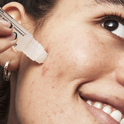 Model applying e.l.f Blemish Breakthrough Fighting Spot Gel on blemish for clear skin treatment.