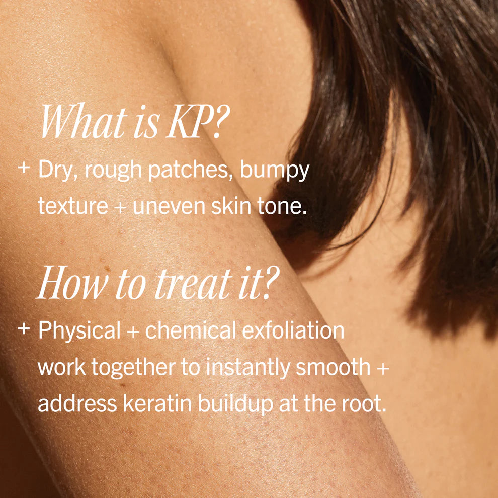 Text explaining First Aid Beauty (Keratosis Pilaris) and treatment methods on a person's arm.