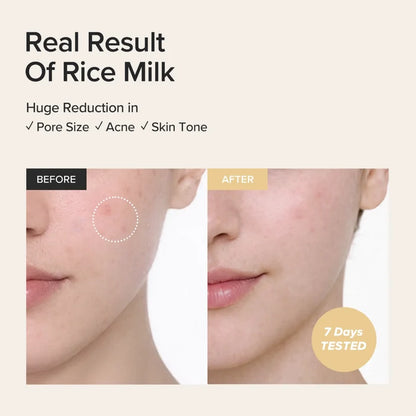 Before and after comparison of rice milk's effect on skin with text highlighting benefits.