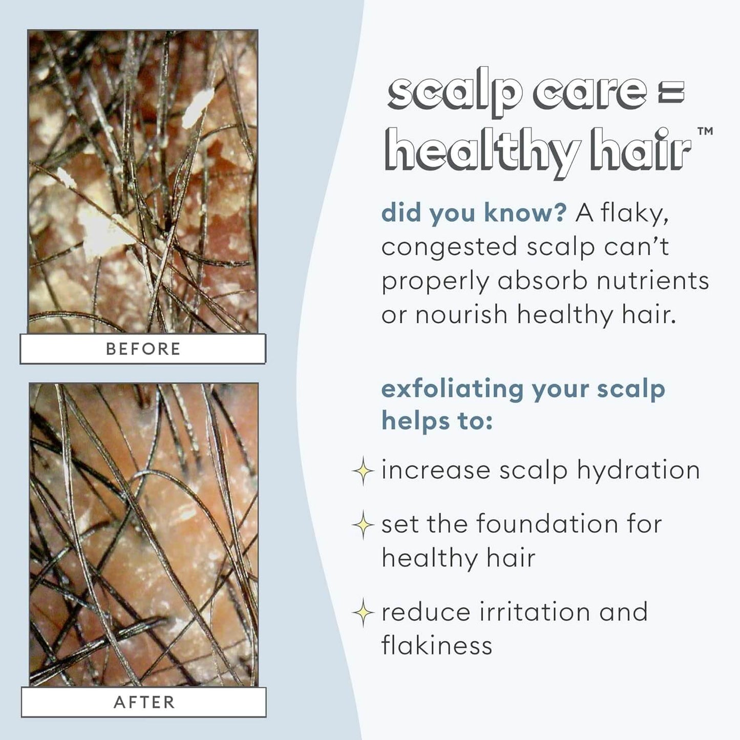 Before and after comparison of scalp care with text about the importance of a healthy scalp for hair health.