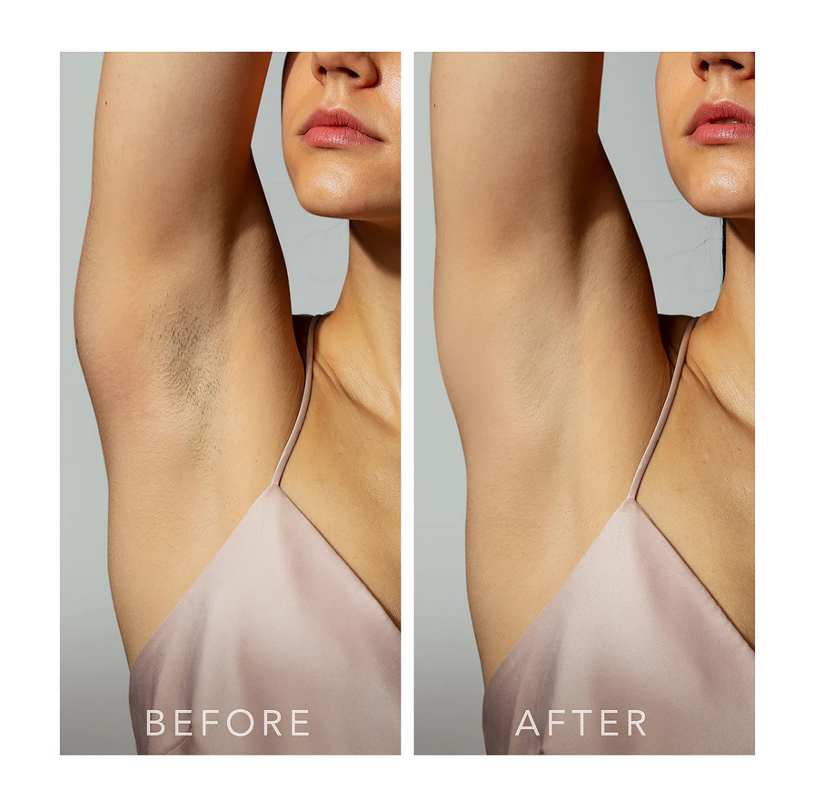 FOREO PEACH 2 go Skin Cooling System - Advanced Hair Reduction IPL Device  - Peach