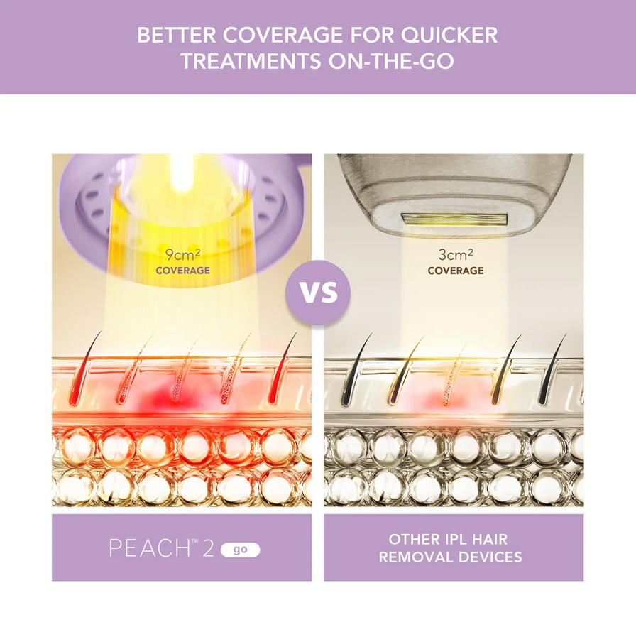 FOREO PEACH™ 2 go Advanced IPL Device with Skin Cooling System - Lavender