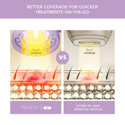 FOREO PEACH™ 2 go Advanced IPL Device with Skin Cooling System - Lavender