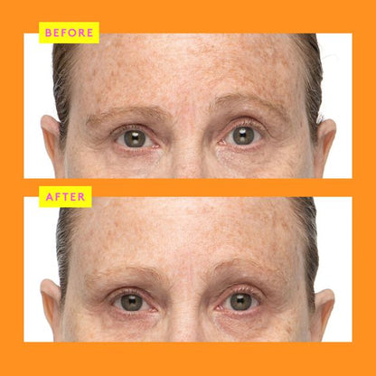 Before and after comparison of a person's face with visible skin texture differences on Drunk Elephant C-firma Fresh Day Serum