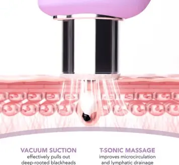 Foreo KIWI™ Derma Diamond Microdermabrasion & Pore Vacuum Device - The Good Vibes