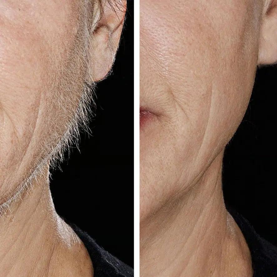 Before and after using Hollywood Browzer for smooth skin and effective hair removal.