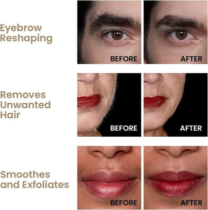 Before and after effects of a Hollywood Browzer procedure on eyebrows, lips, and face.