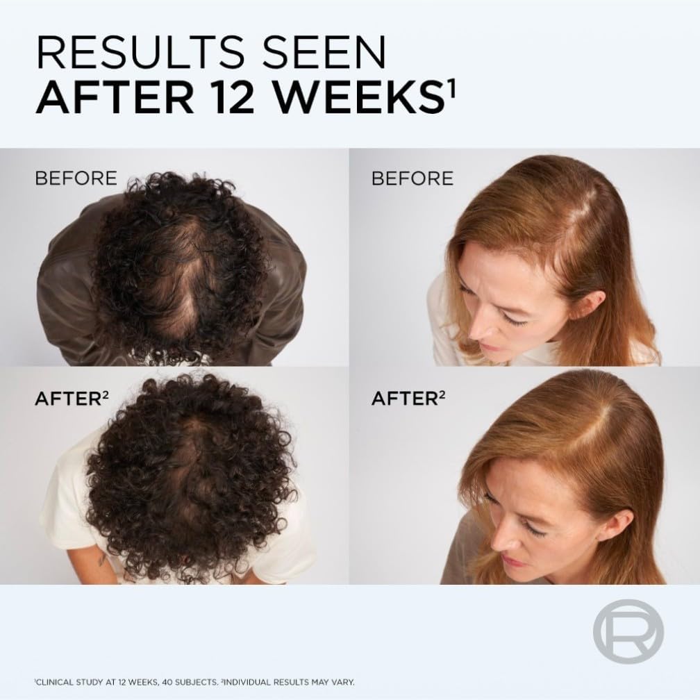 Before and after results of a hair treatment or product application on two individuals' heads.