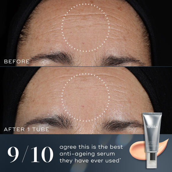 Before and after comparison of a person's forehead with anti-aging serum application, featuring a tube of Medik8 serum.