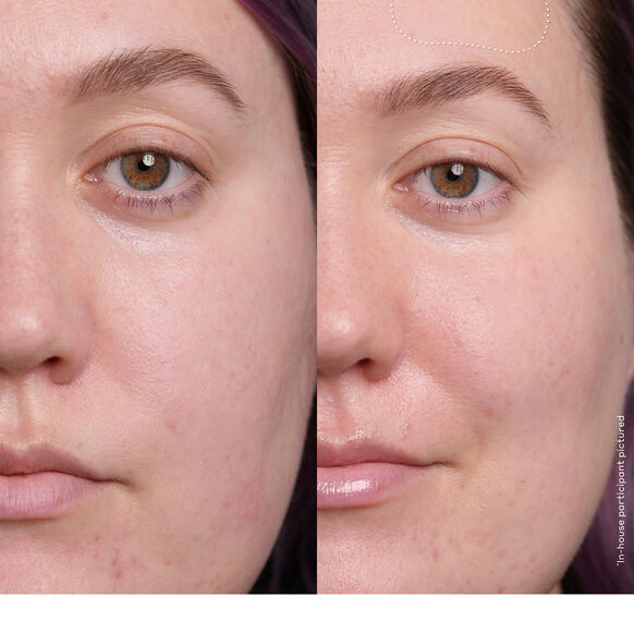Before and after comparison of a woman's face with visible skin texture differences. OLE HENRIKSEN Banana Bright™ Vitamin C Serum