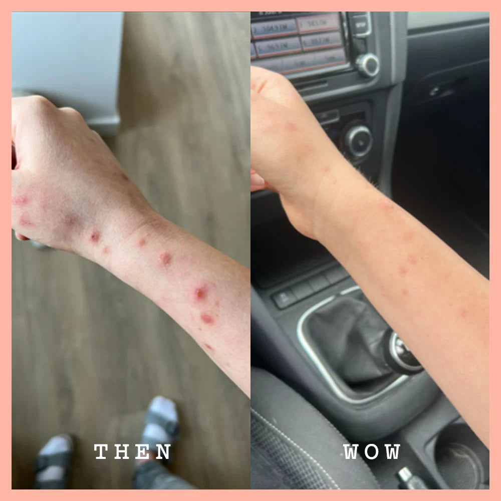 Before and after comparison of a person's arm with visible skin conditions inside a car.
