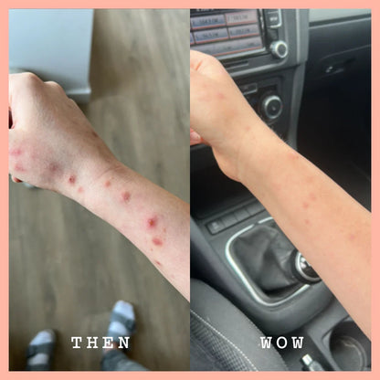 Before and after comparison of a person's arm with visible skin conditions inside a car.
