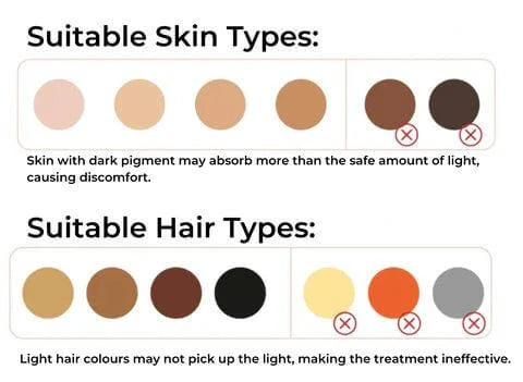 Chart showing suitable skin and hair types for IPL laser hair removal, highlighting safe options for effective treatments.