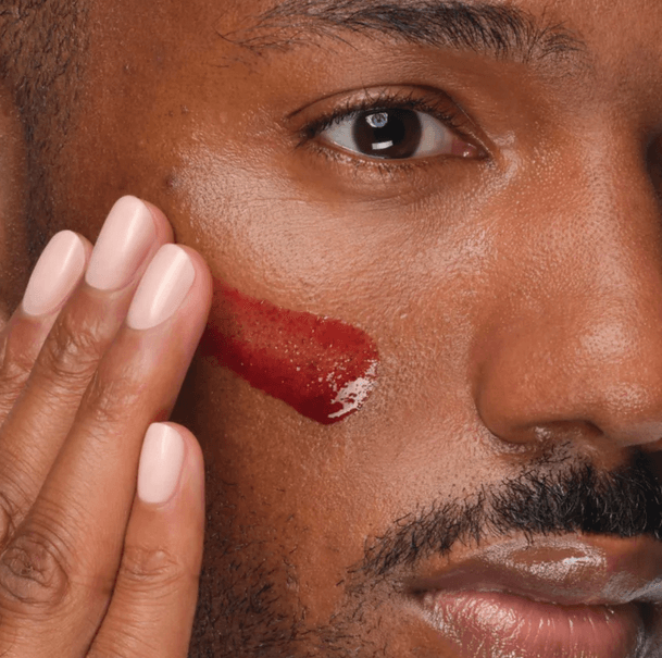 A person applying The Ordinary AHA 30% + BHA 2% Peeling Solution to their face for exfoliation.