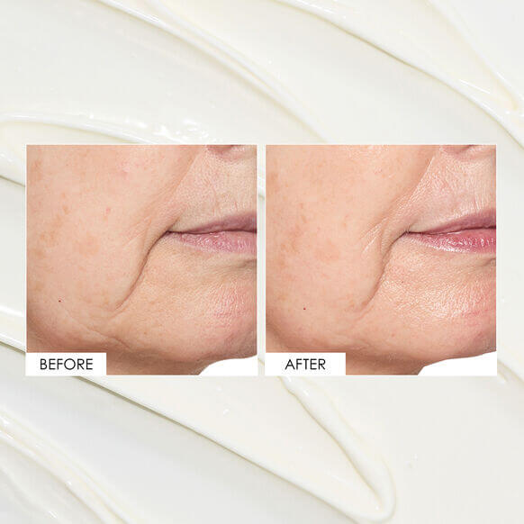 Before and after comparison showing skin improvement using Sunday Riley ICE Ceramide Moisturizing Cream.
