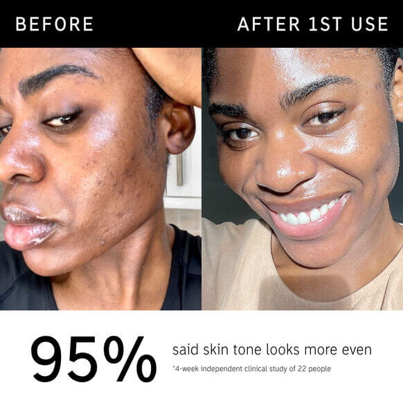 Before-and-after results showing improved skin tone after using THE INKEY LIST Omega Water Cream.