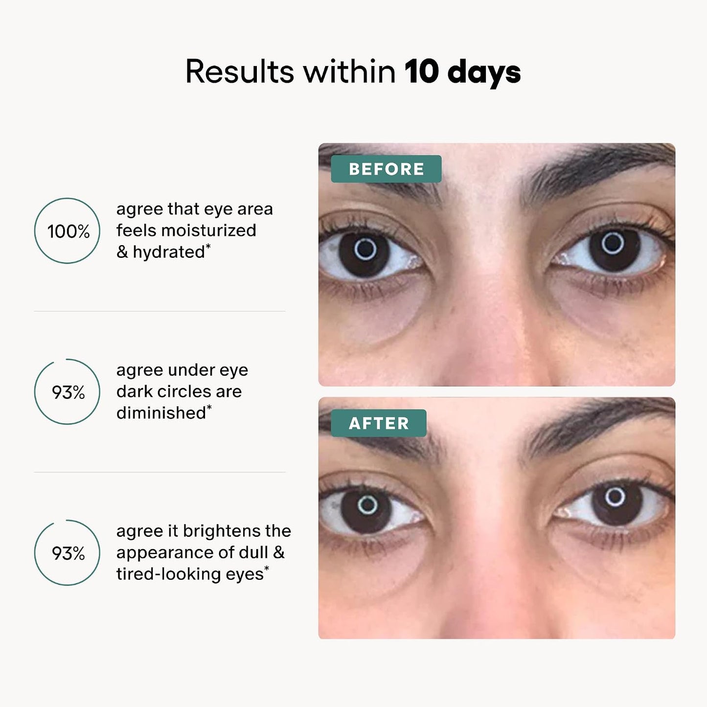 A marketing graphic with the headline 'Results within 10 days' and three benefit statements about moisturized eye area, diminished dark circles, and brighter appearance of tired-looking eyes. The right side shows two close-up eye comparison photos labeled BEFORE and AFTER on a light gray background.