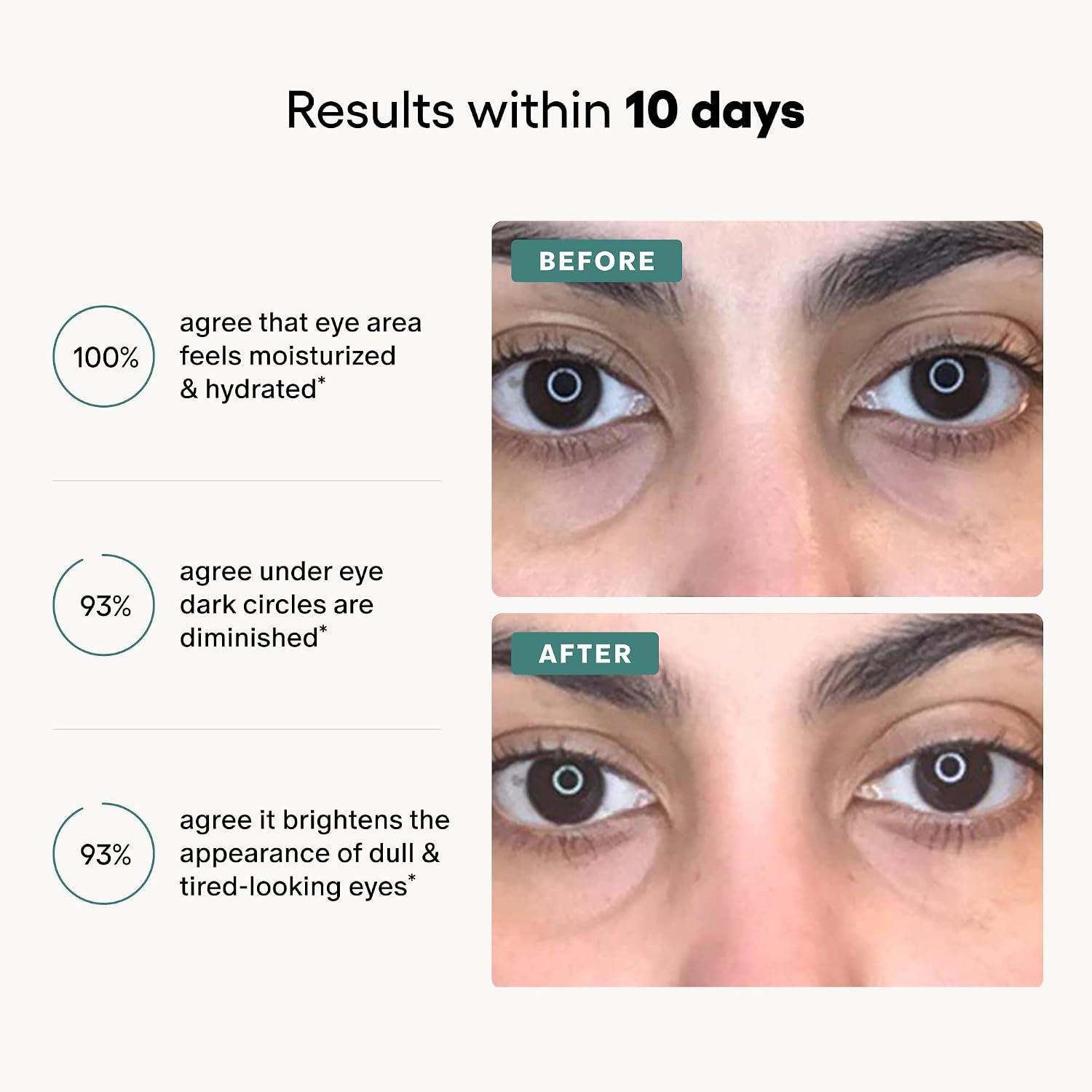 A marketing graphic with the headline 'Results within 10 days' and three benefit statements about moisturized eye area, diminished dark circles, and brighter appearance of tired-looking eyes. The right side shows two close-up eye comparison photos labeled BEFORE and AFTER on a light gray background.