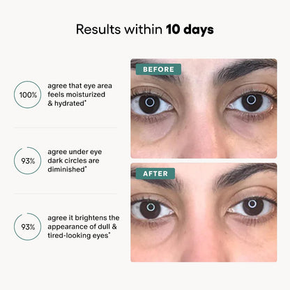 A marketing graphic with the headline 'Results within 10 days' and three benefit statements about moisturized eye area, diminished dark circles, and brighter appearance of tired-looking eyes. The right side shows two close-up eye comparison photos labeled BEFORE and AFTER on a light gray background.