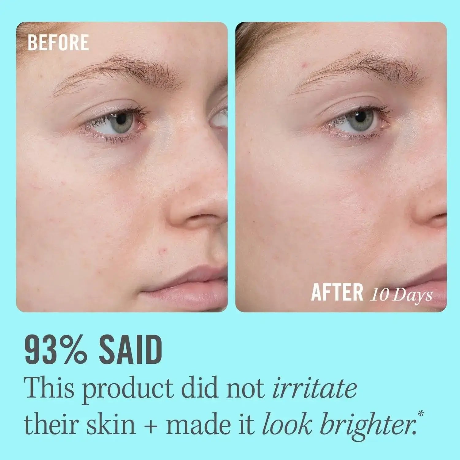 Before and after comparison of skin using First Aid Beauty 10% Vitamin C Serum, showing brighter skin in 10 days.