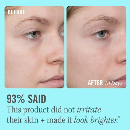 Before and after comparison of skin using First Aid Beauty 10% Vitamin C Serum, showing brighter skin in 10 days.