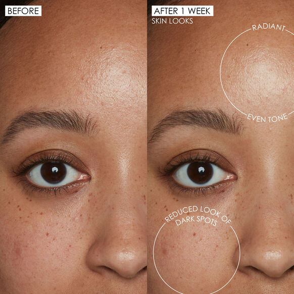Before and after comparison of skin texture and dark spots on a person's face Sunday Riley.