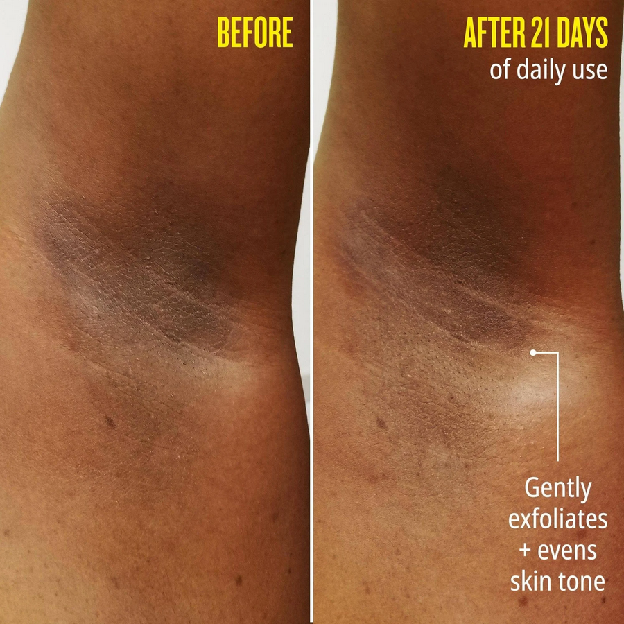 Before and after images showing skin tone improvement after 21 days of use with gentle exfoliation.