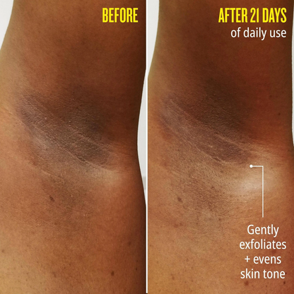 Before and after images showing skin tone improvement after 21 days of use with gentle exfoliation.