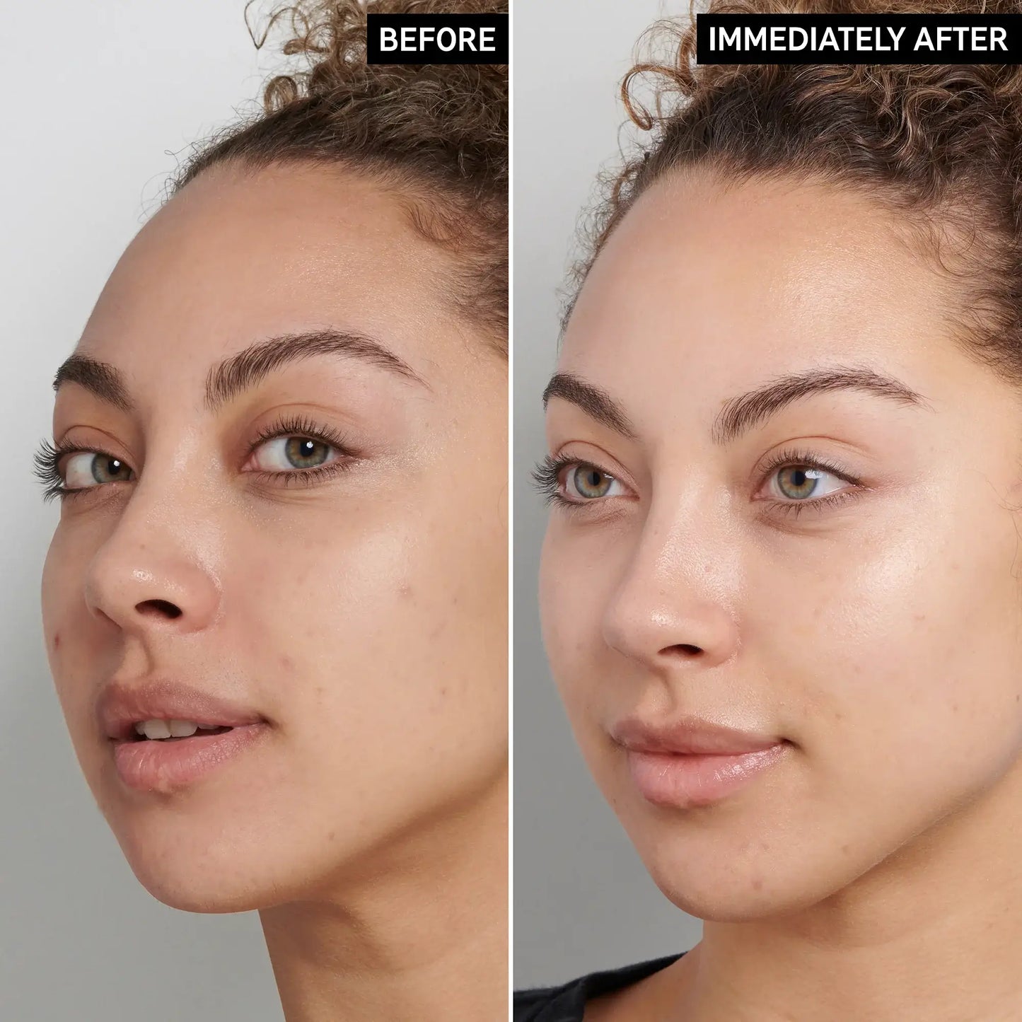 Before and after results showcasing skin improvement using The INKEY List Fulvic Acid Cleanser.
