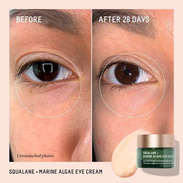 Before and after results of using Biossance Squalane + Marine Algae Eye Cream for 28 days.