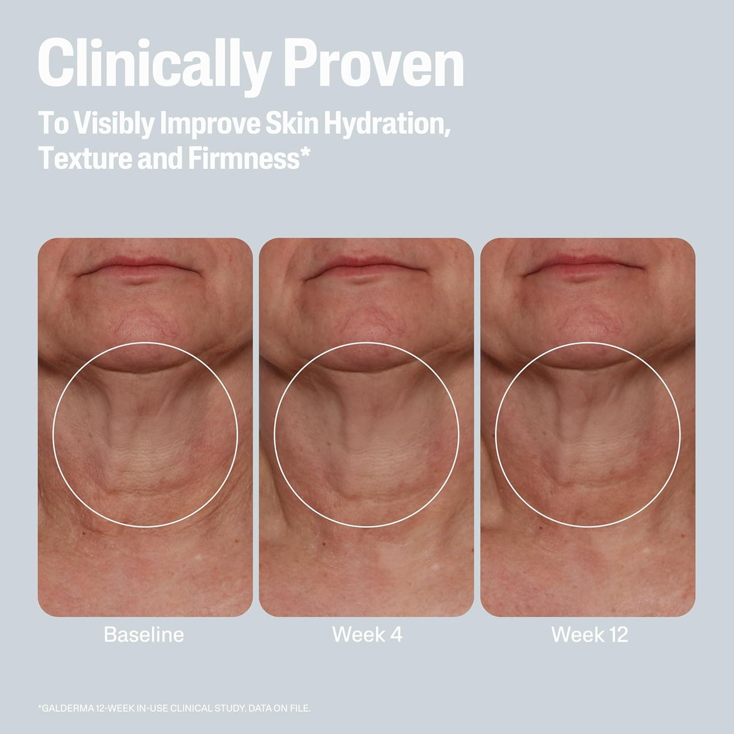 Before and after Cetaphil skin hydration, texture, and firmness improvement over time on a light gray background.