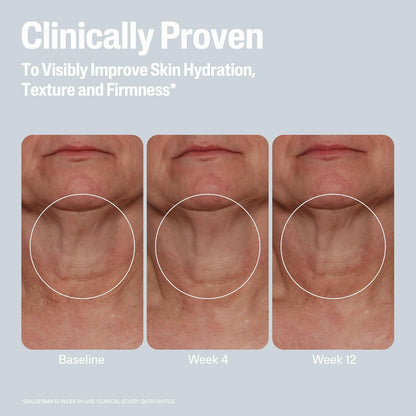 Before and after Cetaphil skin hydration, texture, and firmness improvement over time on a light gray background.