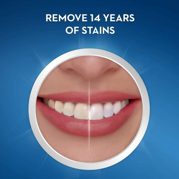 Before and after smile showing results of Crest 3D Whitestrips, removing 14 years of stains.